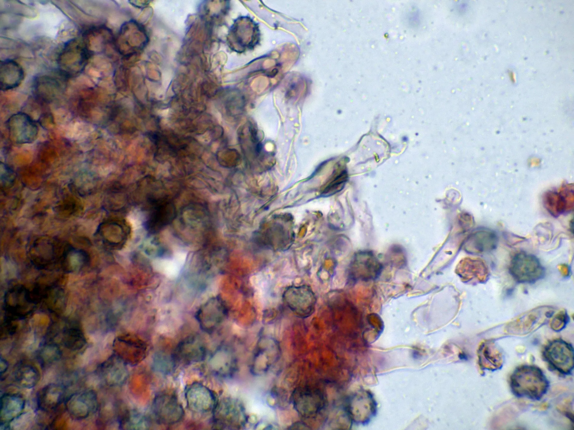 Microscopía de Tomentella testaceogilva - 10 - Basidios-003